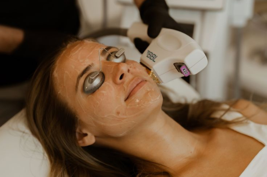 The Latest in Rosacea Care: Light and Laser Treatments