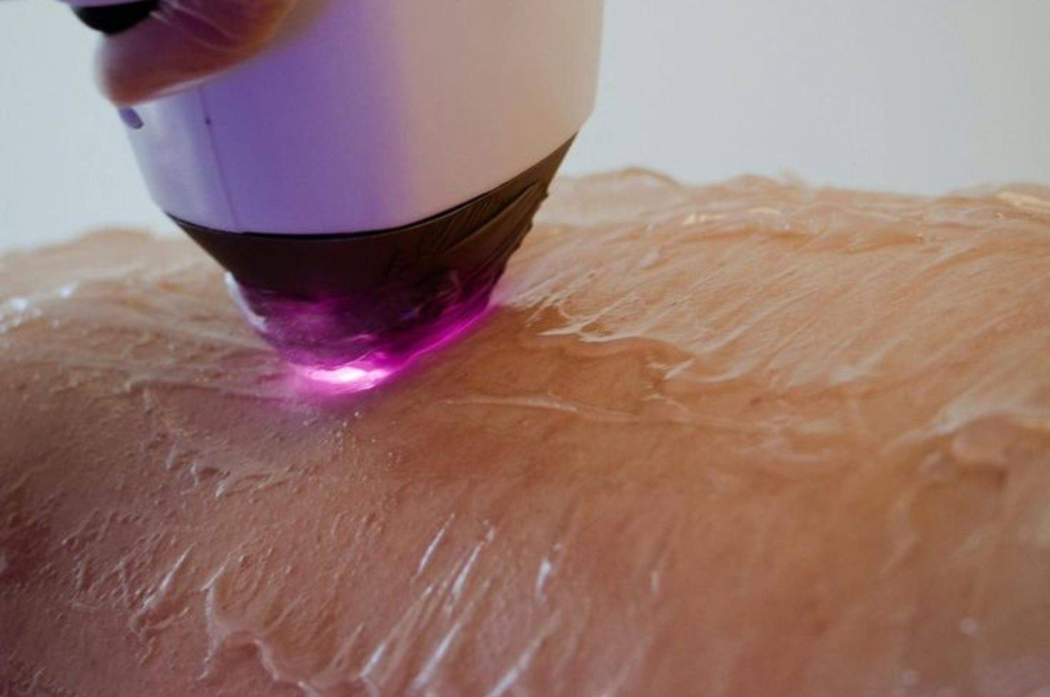 The New Generation of Lasers: What I’m Watching as a Skincare Founder