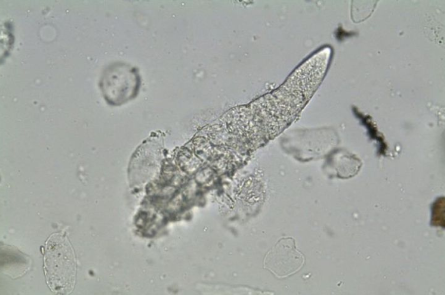 The Itchy Truth About Demodex Mites and How They’re Linked to Rosacea