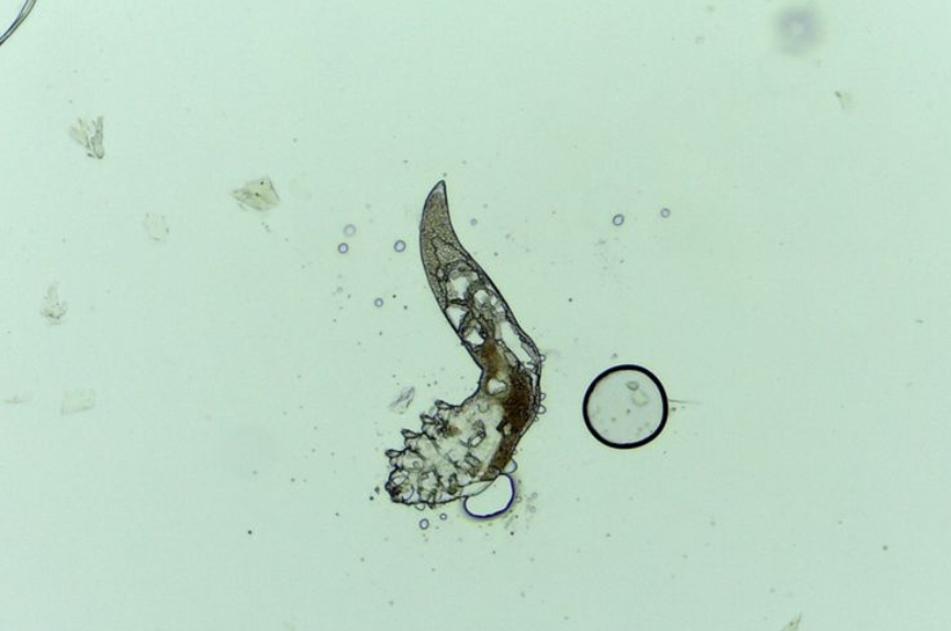 Unveiling the Link Between Demodex Mites and Rosacea: What You Need to Know