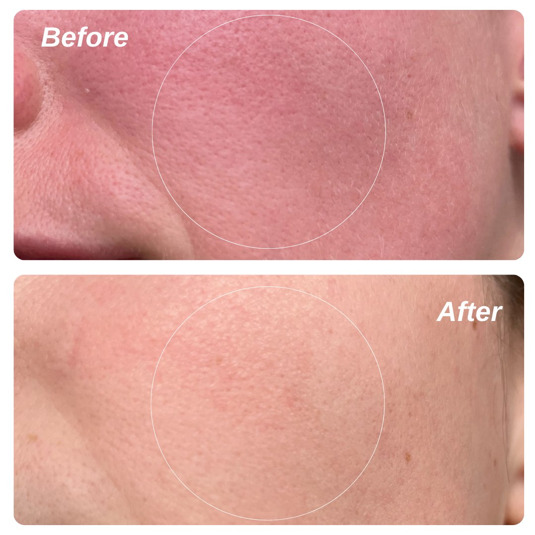 Ruddi Redness Control 1.7oz (50ml)