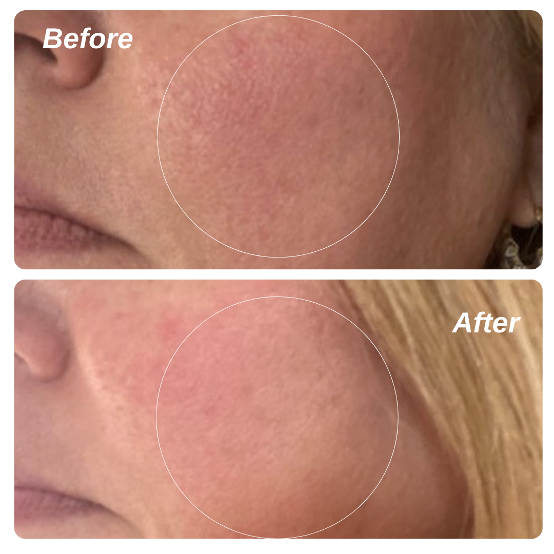 5% Vita C + Ceramides for Sensitive Skin