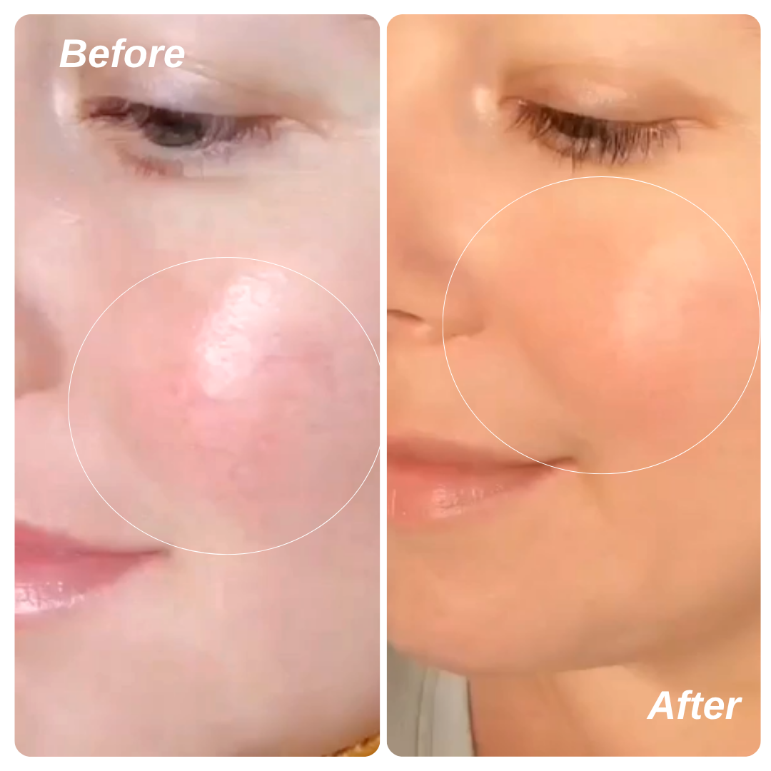 Ruddi Redness Control 1.7oz (50ml)