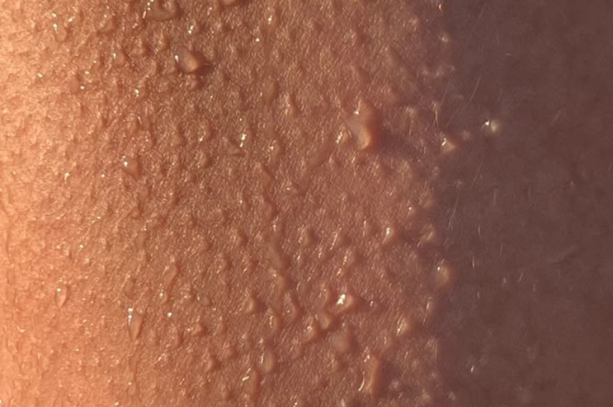 Meet Your Skin Microbiome: The Invisible Ecosystem on Your Face