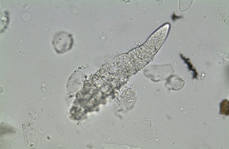 The Itchy Truth About Demodex Mites and How They’re Linked to Rosacea