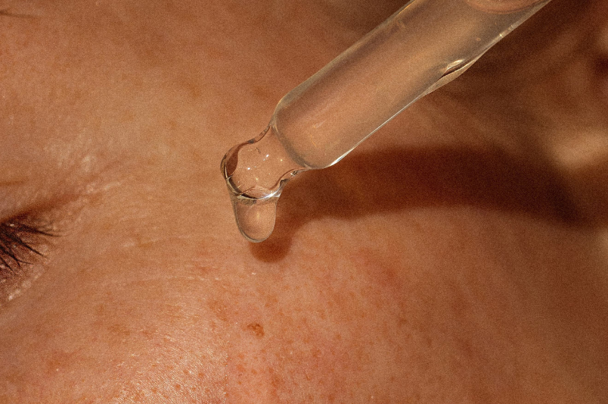Top 3 Serums for Rosacea-Prone Skin